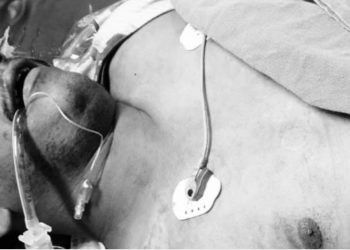 विराटनगरका चौधरीकाे धरानमा गाेली हानी हत्या